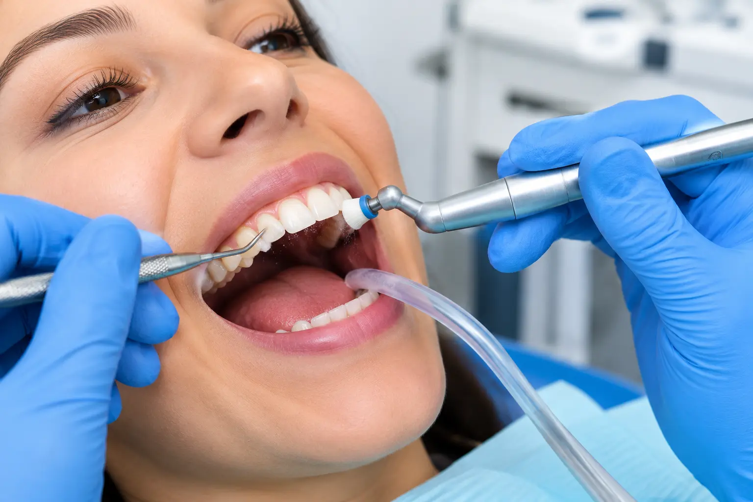 Teeth cleaning at Kapoor's Safe Hands Dental, Gurugram